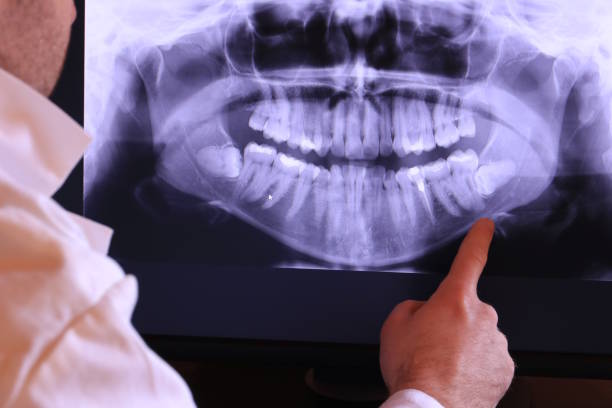Best Emergency Treatment for Dental Infections or Abscesses in Byron, MN